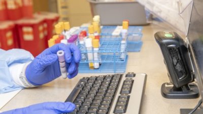 Research-group-publishes-landmark-study-examining-diagnostic-access-in-Indias-fight-against-tuberculosis-1.jpg